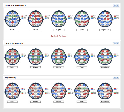 brain mapping assessment qeeg capital district new york with dr cale